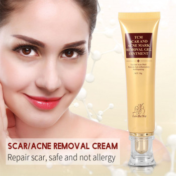 Anti Acne Face Cream-Spring Flower On Discount